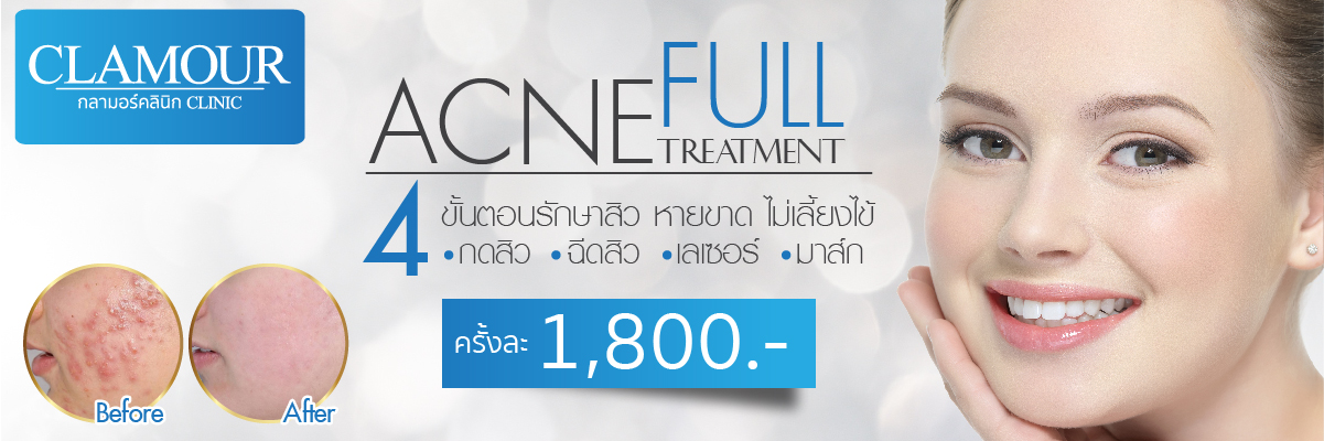 Acne full Treatment